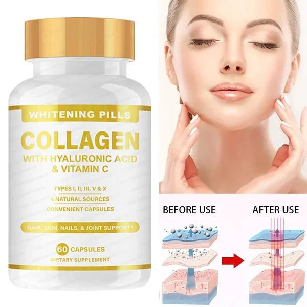 1 Bottle Skin Whitening Collagen Capsule Supplemented with Vitamin C Whitening Skin Antioxidant Stress. in Pakistan in Pakistan 1 Bottle Skin Whitening Collagen Capsule Supplemented with Vitamin C Whitening Skin Antioxidant Stress. in Pakistan in Pakistan