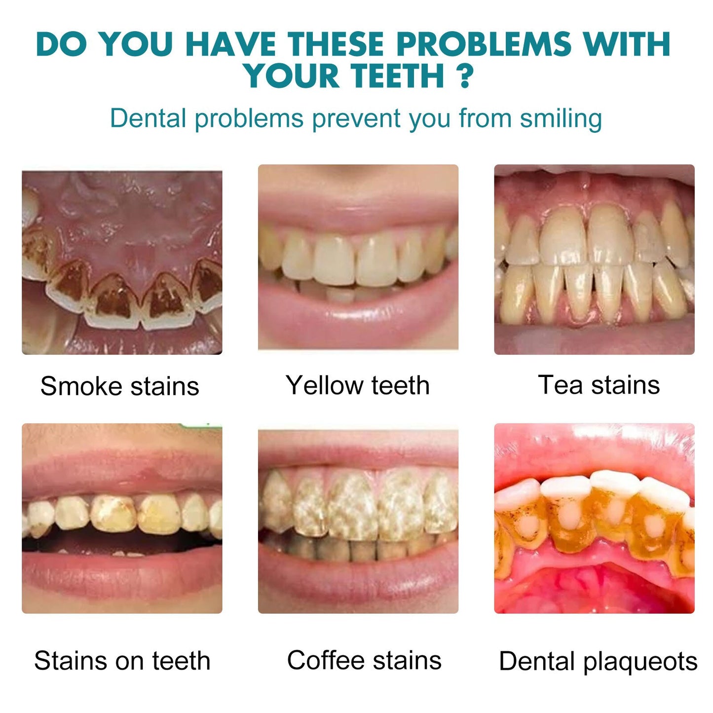 1pcs Instant Whitening Paint Tooth Stain Remove Teeth Clean Tooth Whitening Paint Oral Hygiene Health Natural Universal Hygienic