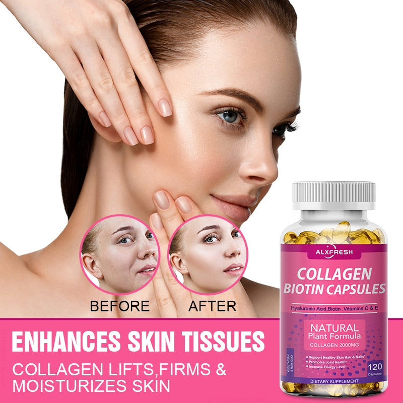 Alxfresh 3X Collagen Biotin Supplement Protein Support Anti Aging Strong Nails Shiny Hair Glowing Smooth Skin Vegan Capsules