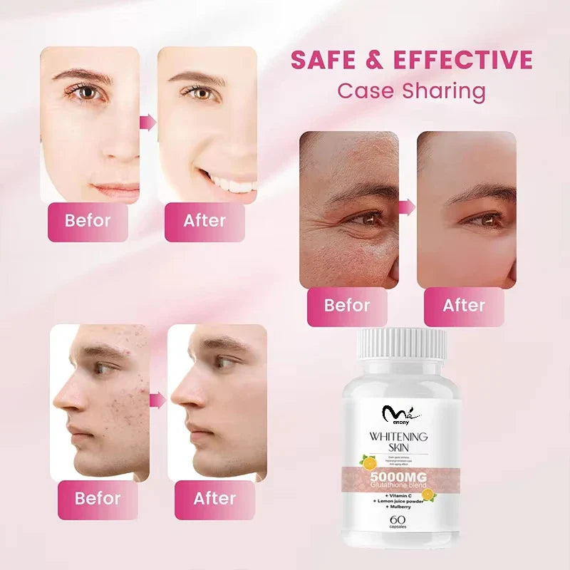 Glutathione Whitening Pills - Dark Spots & Acne Scar Remover Vegan Skin Bleaching Pills with Anti-Aging