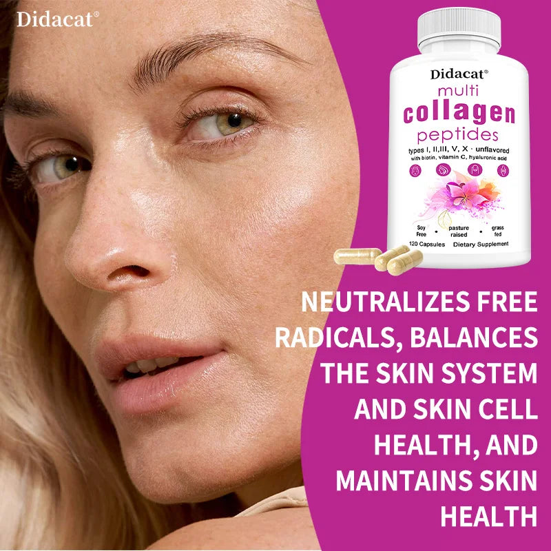 Multi-Collagen Peptides Supplement - Skin, Hair, Nails, Bone and Joint Health, Immunity, Free Radical Balance, Non-GMO