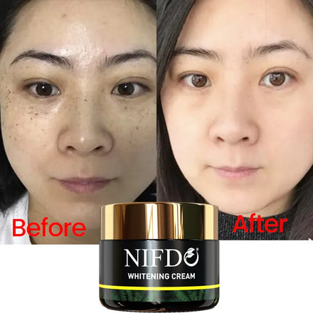 Nifdo Whitening Cream in Pakistan, Anti Wrinkle and Anti Aging Cream in Pakistan