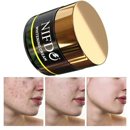 Nifdo Whitening Cream in Pakistan, Anti Wrinkle and Anti Aging Cream in Pakistan