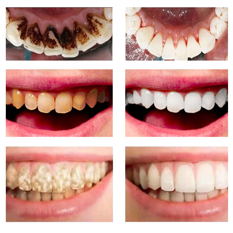 Teeth Whitening Powder Oral Treatment Natural Activated Charcoal Bright Dental Fresh Breath Remove Plaque Stains Hygiene Care