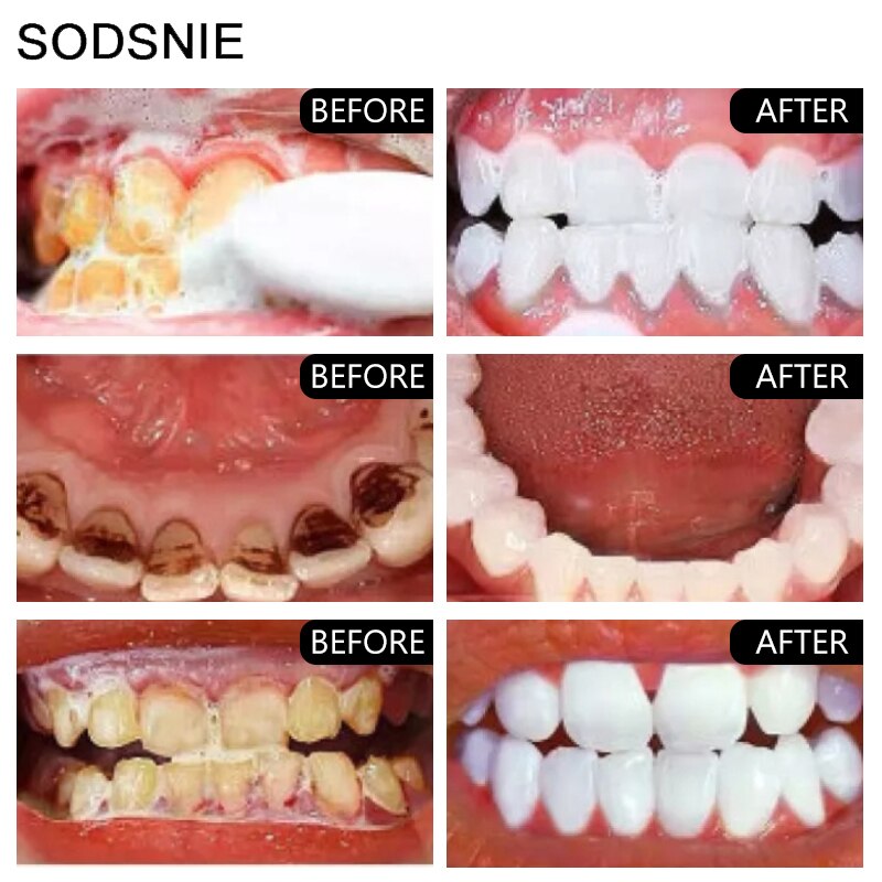 Pearl Teeth Whitening Powder Tooth Brightening Products Remove Plaque Stains Oral Hygiene Essence Teeth Cleaning Toothpaste 30g