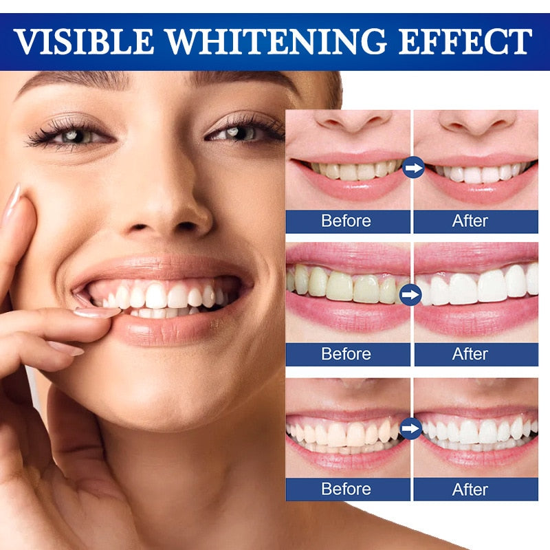 Teeth Whitening Serum Pen Remove Plaque Stains Bleach Tooth Essence Deep Cleaning Oral Hygiene Fresh Breath Dental Care Products