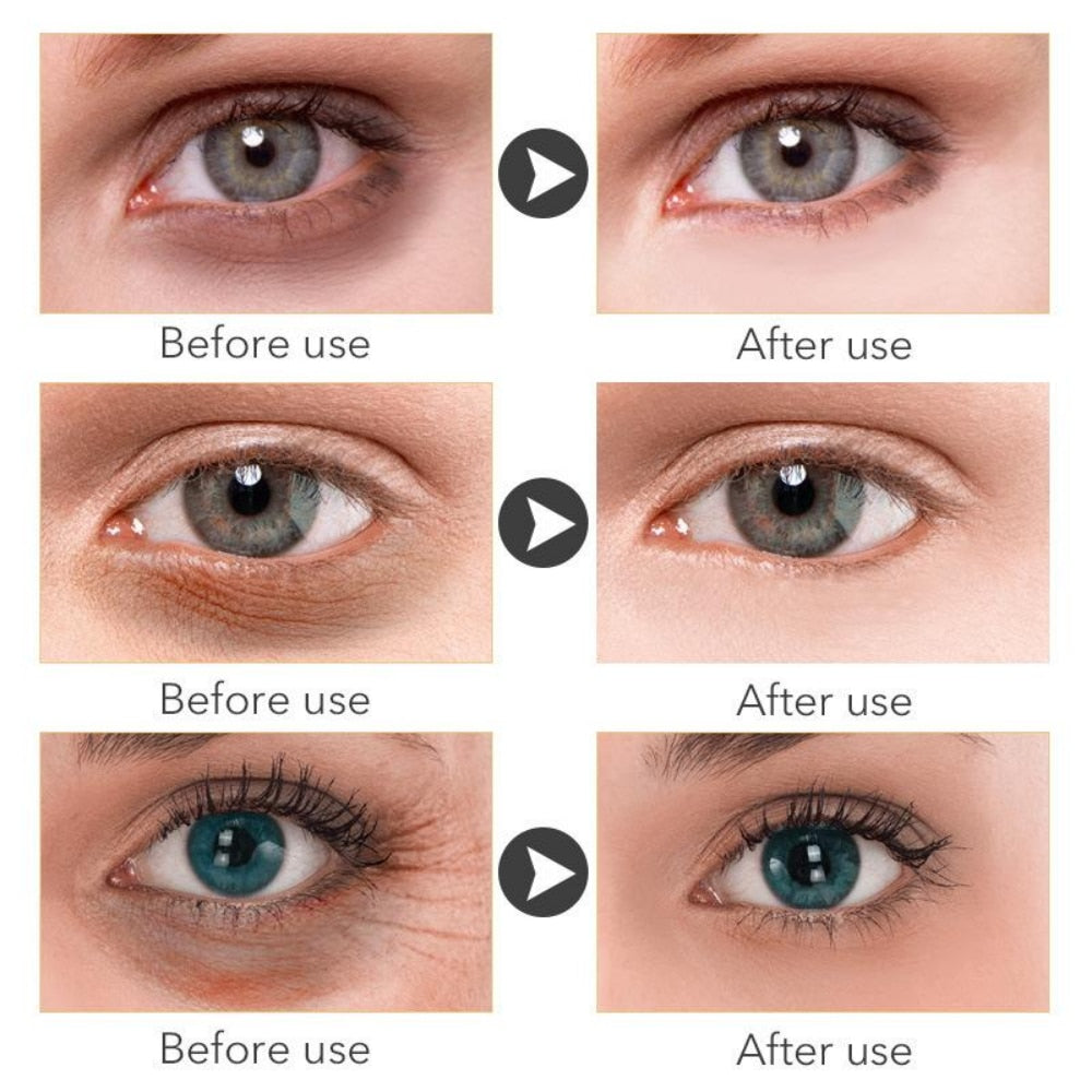 Retinol Anti-aging Whitening Oil Control Eye Serum Gold Serum Korean Skin Care Products
