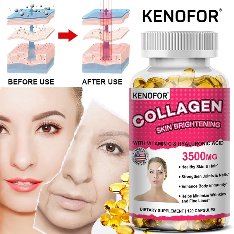 Vital Vitamins Collagen - Biotin, Hyaluronic Acid, Vitamin C - Collagen for Women - Anti-Aging Hair, Skin, Nails Beauty Complex