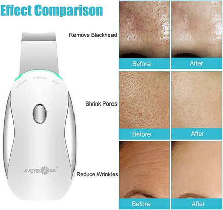 Facial Scrubber Spatula Blackhead Remover Pore Cleaner Beauty Lifting Tool