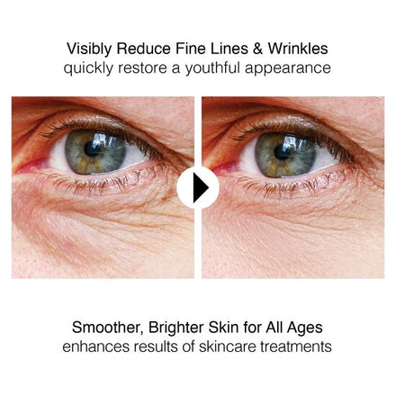 NuDerma Portable Skin Therapy Wand Machine Anti-Aging - Skin Tightening - Wrinkle Reducing