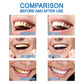 10ml Teeth Whitening Essence Teeth Brightening Bleaching Serum Effect Remove Plaque Stain Oral Cleanser