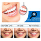 10ml Teeth Whitening Essence Teeth Brightening Bleaching Serum Effect Remove Plaque Stain Oral Cleanser