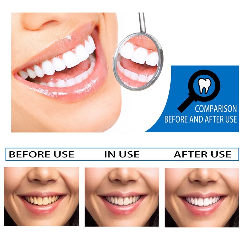 10ml Teeth Whitening Essence Teeth Brightening Bleaching Serum Effect Remove Plaque Stain Oral Cleanser