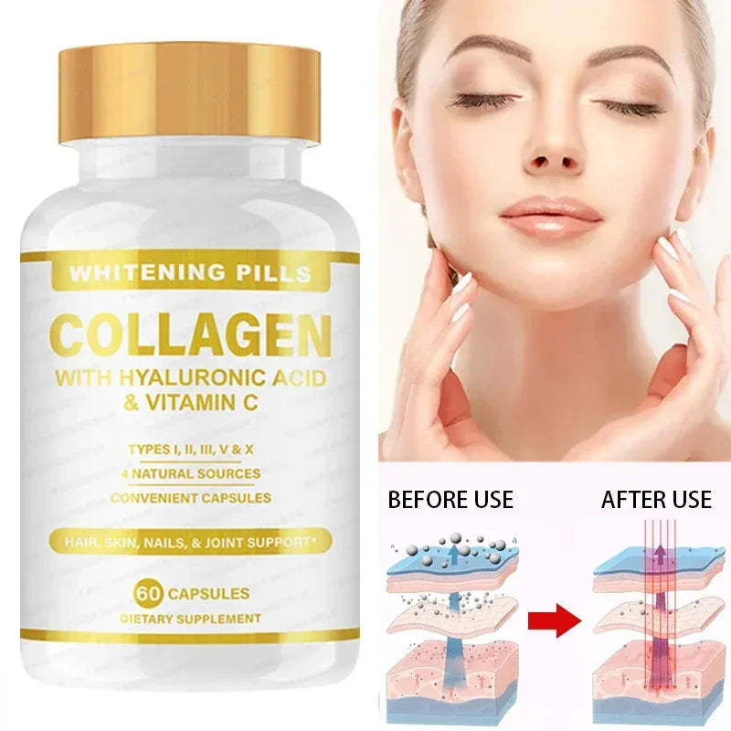 1 Bottle Skin Whitening Collagen Capsule Supplemented