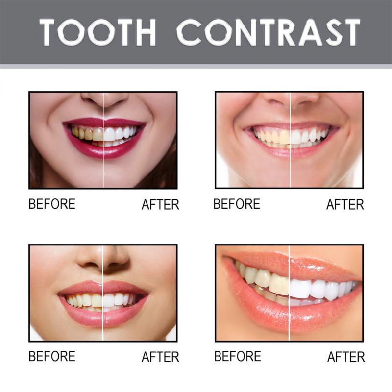 4ML Teeth Whitening Pen White Instant Tooth Removal Stains Teeth Whitening Gel Oral Care Clean Teeth Tooth Whitening Products