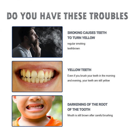 4ML Teeth Whitening Pen White Instant Tooth Removal Stains Teeth Whitening Gel Oral Care Clean Teeth Tooth Whitening Products