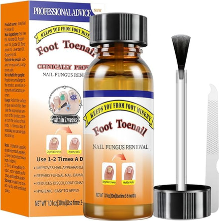 Toenail Fungus Treatment Extra Strength Fluids,fungus Nail Treatment Soft Brush Head Escalate,Transform Your Toenails with Ease,fungal Nail Treatment Let Your Experience Confidence Every Step (30ML) in Pakistan