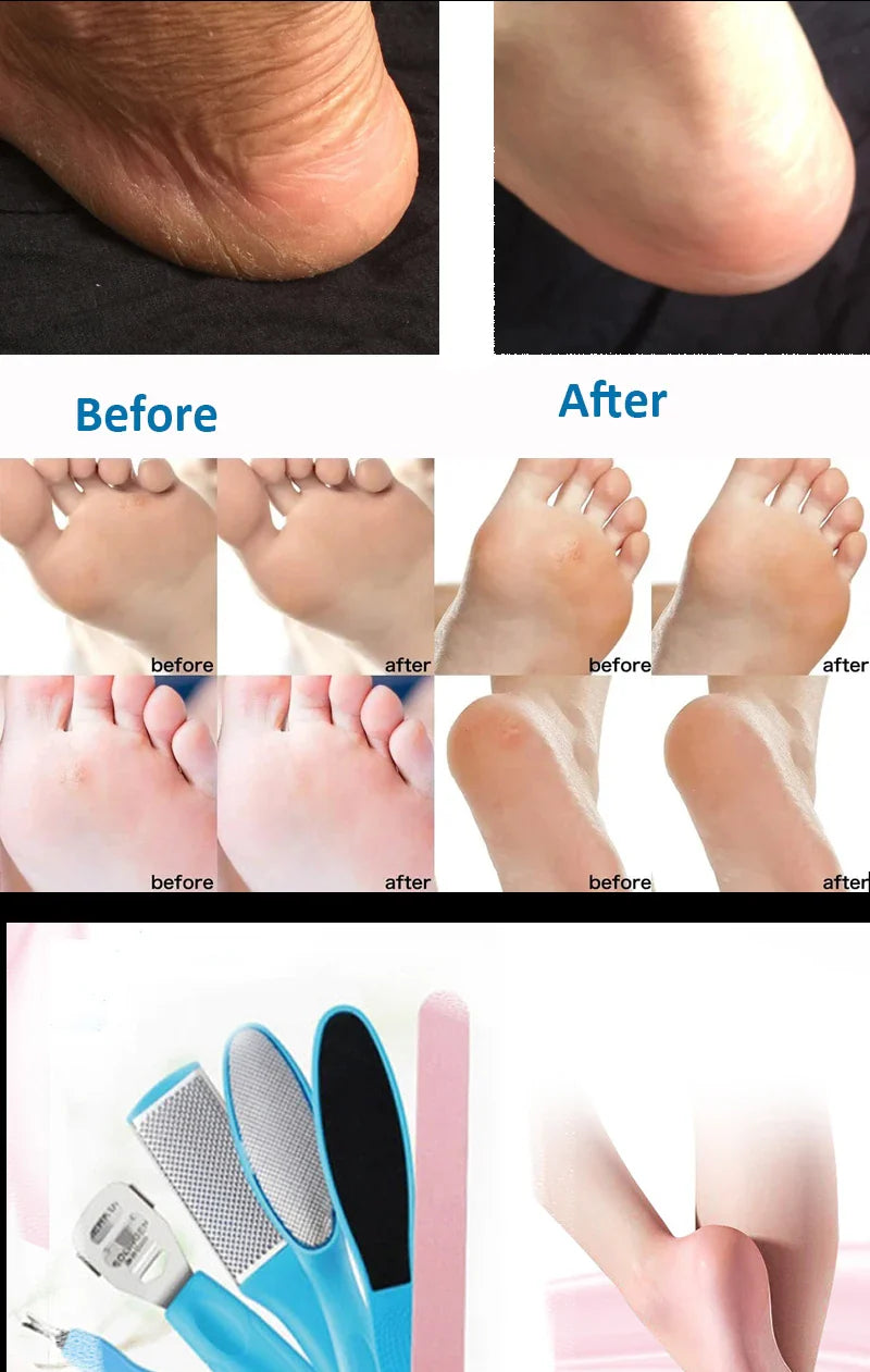 8 Piece Set Foot Rasp High Stainless Steel Remover Exfoliating Heel Sharpener Dead Skin Crackles Removal Nail Foot Care Tool