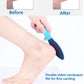 8 Piece Set Foot Rasp High Stainless Steel Remover Exfoliating Heel Sharpener Dead Skin Crackles Removal Nail Foot Care Tool