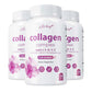 Collagen Complex – Nutritional Supplement That Helps Whiten & Brighten Skin, Joints, Nails, Hair Support, and Relieve Fine Lin