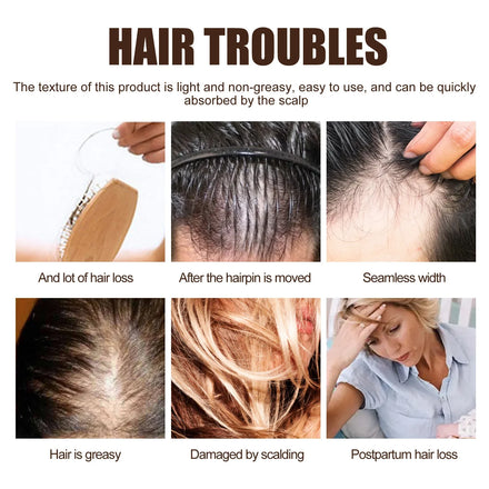EELHOE Hair Growth Serum Thicken Anti Hair Loss Damaged Thinning Repair Dry Scalp Treatment Keratin Nourishing Essence Products