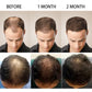 Ginger Hair Growth Products Fast Growing Hair Essential Oil Natural Anti Hair Loss Prevent Hair Dry Frizzy Damaged Repair Care