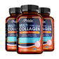 Multi Collagen Peptides with Golden Turmeric - Antioxidant, Moisturizes Skin, Reduces Fine Lines, Supports Skin, Hair and Joints