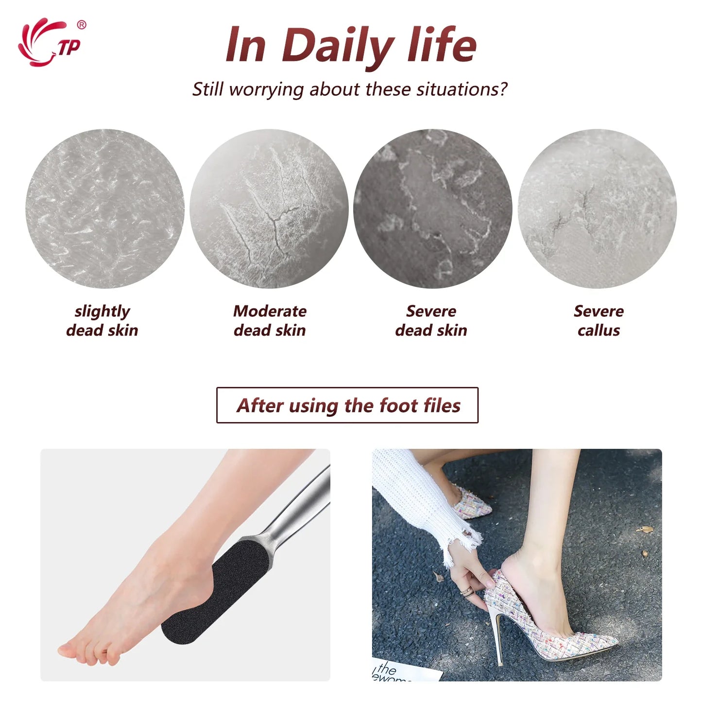 Pedicure Rasp File Callus Remover Foot Files Pedicure Pads Stainless Handle Silencer For Foot Care Tools Replaceable Sandpaper