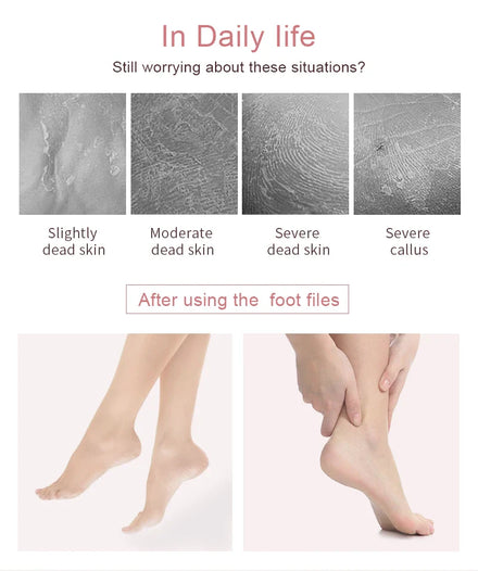 Pedicure Rasp File Callus Remover Foot Files Pedicure Pads Stainless Handle Silencer For Foot Care Tools Replaceable Sandpaper