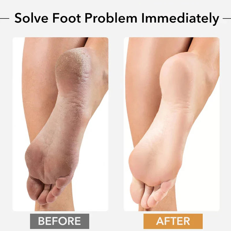 Professional Pedicure Rasp Tool for Dead Skin Crack Heels Beech Wood Foot File Rasp Callus Remover Foot Scrubber