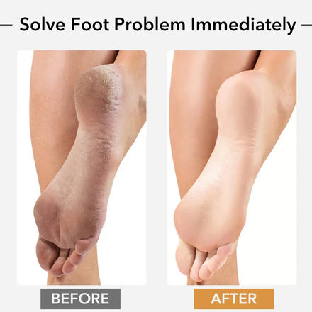 Professional Pedicure Rasp Tool for Dead Skin Crack Heels Beech Wood Foot File Rasp Callus Remover Foot Scrubber
