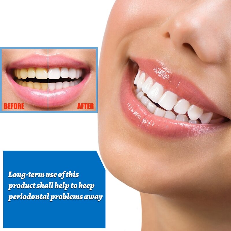 10ml Teeth Whitening Essence Teeth Brightening Bleaching Serum Effect Remove Plaque Stain Oral Cleanser