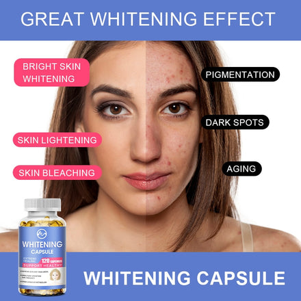 Minch Whitening Capsules Glutathione Softgels Effective Skin Lighten Supplement Dark Spots Melasma Acne Scar Remover Antioxidant