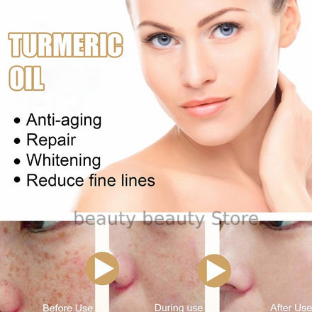 Turmeric Oil Skin To Lightening Acne Dark Patches Acne Bright Skin Dark Spot Corrector Anti Aging Face Whitening Serum Care