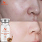 Pore Ampoule Snail100% Essence Hyaluronic Acid Liquid Whitening Spot Essence Shrink Pores Ampoule Anti-acne Regenerative Essence