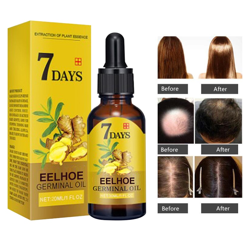 Ginger Hair Growth Products Fast Growing Hair Essential Oil Natural Anti Hair Loss Prevent Hair Dry Frizzy Damaged Repair Care