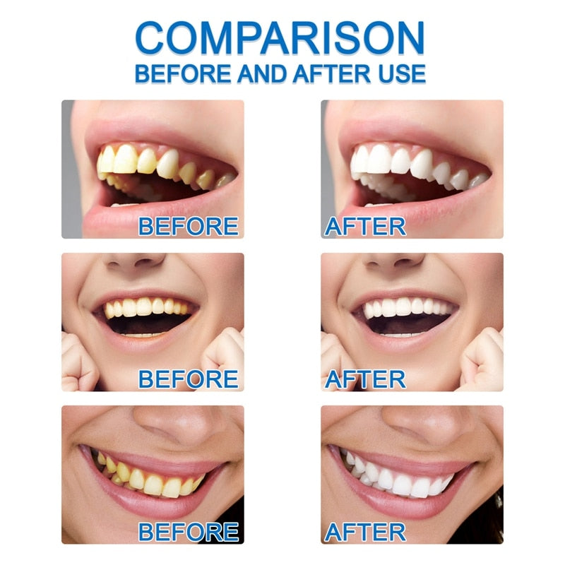 10ml Teeth Whitening Essence Teeth Brightening Bleaching Serum Effect Remove Plaque Stain Oral Cleanser