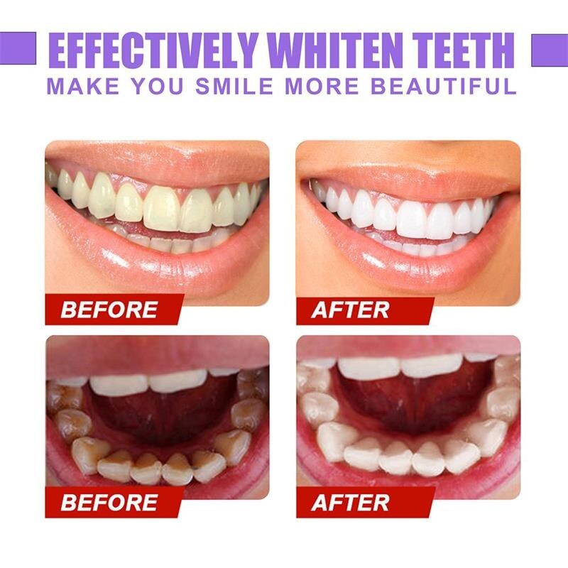 Teeth Whitening Serum Tooth Oral Hygiene Essence Effective Remove Plaque Stains Brightening Product Teeth Cleaning Mouth Wash