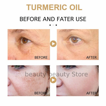 Turmeric Oil Skin To Lightening Acne Dark Patches Acne Bright Skin Dark Spot Corrector Anti Aging Face Whitening Serum Care