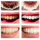 Teeth Whitening Powder Oral Treatment Natural Activated Charcoal Bright Dental Fresh Breath Remove Plaque Stains Hygiene Care