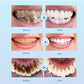 Teeth Whitening Serum Effective Remove Stains Plaque Deep Cleansing Dental Oral Hygiene Gel Teeth Whitening Kit Beauty Health