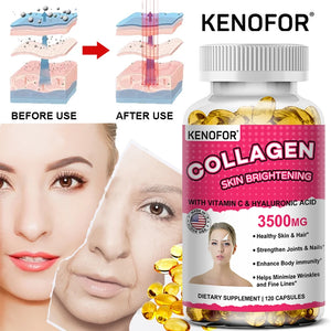 Vital Vitamins Collagen - Biotin, Hyaluronic Acid, Vitamin C - Collagen for Women - Anti-Aging Hair, Skin, Nails Beauty Complex