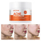 Acne Treatment for Face, Salicylic Acid Acne Cream Back Acne Treatment Cream