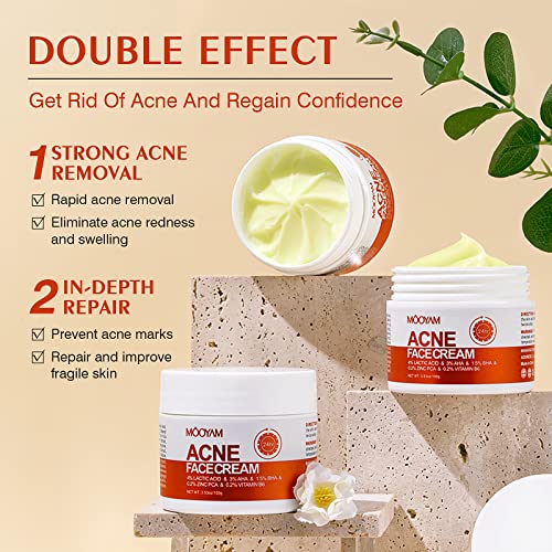 Acne Treatment for Face, Salicylic Acid Acne Cream Back Acne Treatment Cream