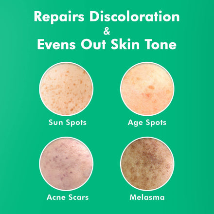 Ebanel Dark Spot Remover for Face, Peel Skin Brightening Serum, Sun Spot Age Spot Freckle Remover serum