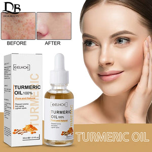 30ml Turmeric Oil Skin To Lightening Acne Dark Patches Acne Bright Skin Dark Spot Corrector Anti Aging Face Whitening Serum Care