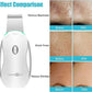 Facial Scrubber Spatula Blackhead Remover Pore Cleaner Beauty Lifting Tool