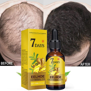 Ginger Hair Growth Products Fast Growing Hair Essential Oil Natural Anti Hair Loss Prevent Hair Dry Frizzy Damaged Repair Care