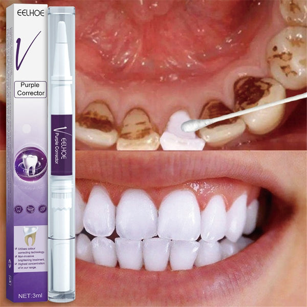 Teeth Whitening Pen Removes Plaque Stains Essence Tooth Bleaching Cleaning Serum White Teeth Oral Hygiene Tooth Whitening Care in Pakistan