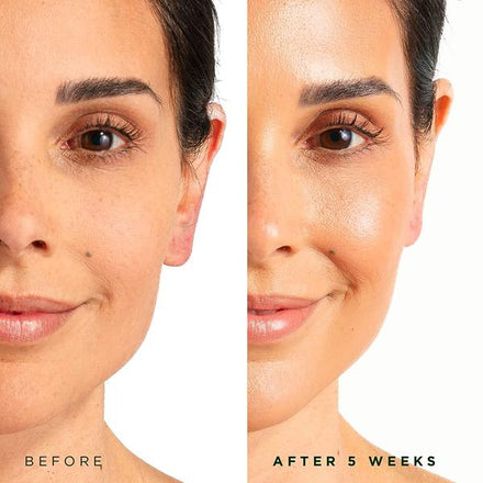 Vitamin C Brightening Facial Serum with Moisturizing Vitamin E for Glowing Radiant Skin